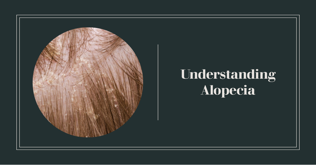 Understanding Alopecia: Causes, Types, and Treatment Options