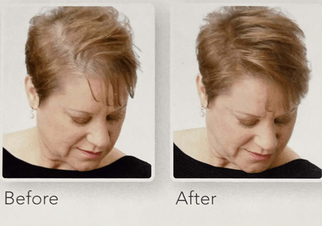 XFusion Hair Fibers: The Instant Solution for Fuller, Thicker Hair