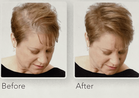 XFusion Hair Fibers: The Instant Solution for Fuller, Thicker Hair